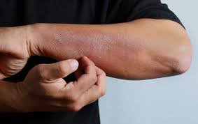 Common Skin Conditions